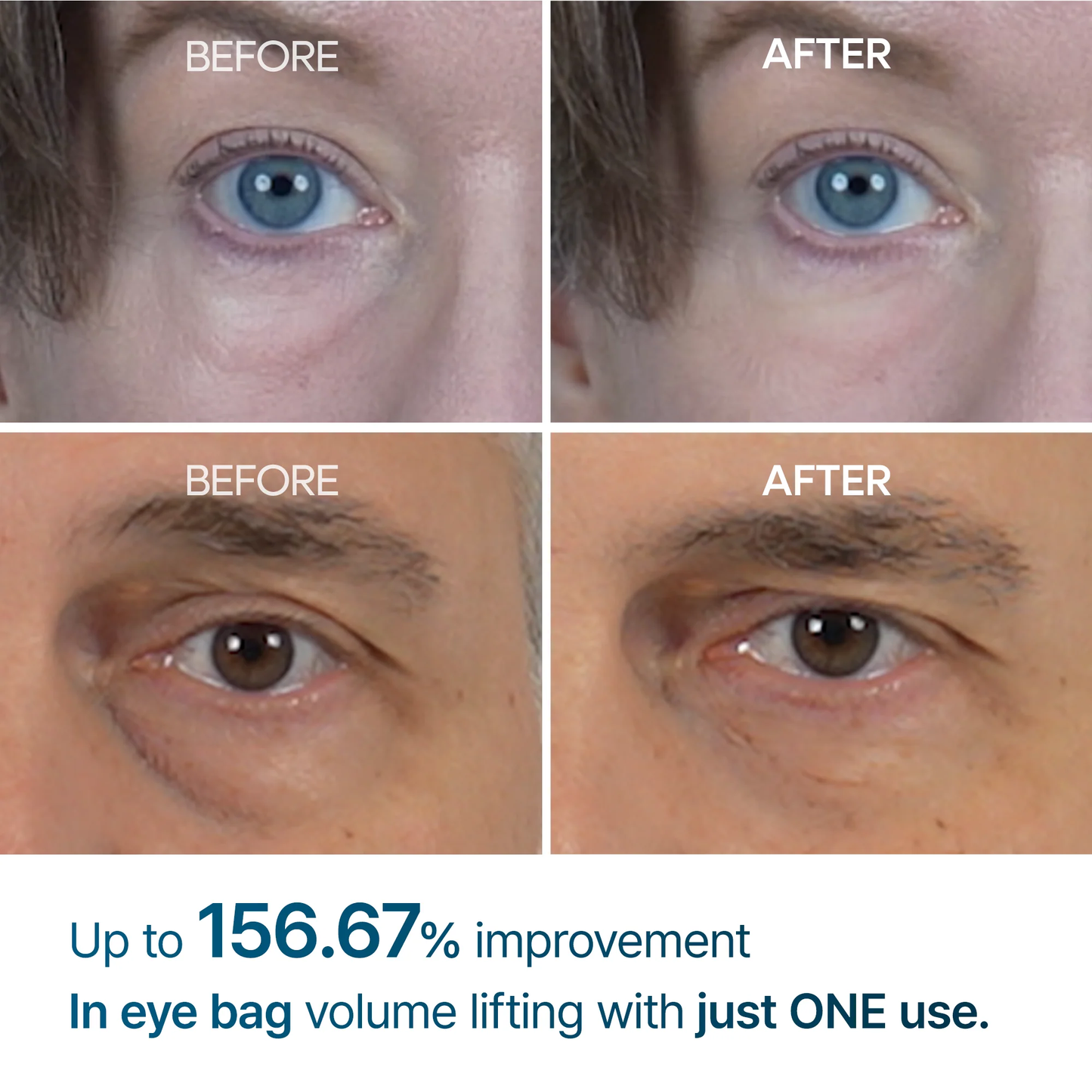 Dr.Melaxin - Eyephalt Eyebag Cream 10g