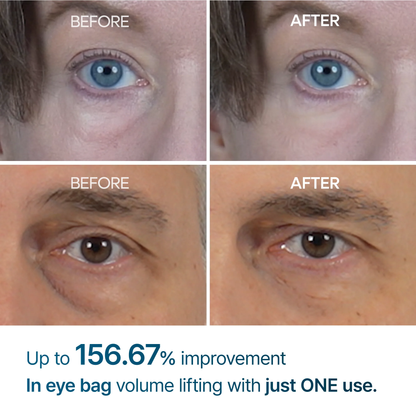 Dr.Melaxin - Eyephalt Eyebag Cream 10g